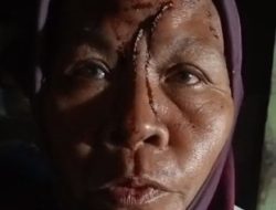 Seorang Ibu di Desa Kalowang, Sumenep Dianiaya Tetangga dengan Sajam Akibat Cekcok Mulut