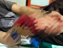 Pengeroyokan di Bilis-Bilis, Tangan Korban Nyaris Putus, Motif Masih Misterius